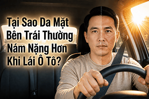 vi-sao-da-mat-ben-trai-de-bi-nam-hon-khi-lai-o-to
